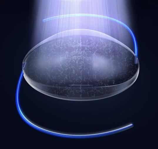The Light Adjustable Lens