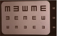 astigmatism treatment boca raton