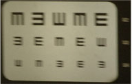 care for astigmatism