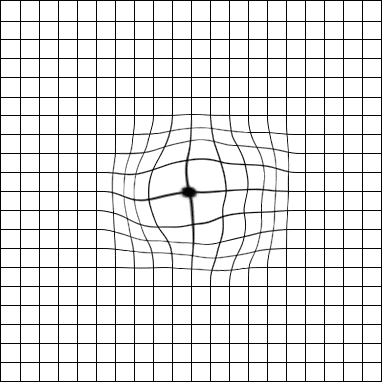 amsler grid with macular degeneration